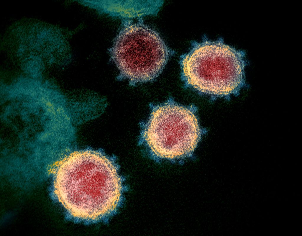 COVID-19: Unraveling the Pandemic's Impact